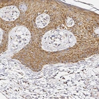 Immunohistochemical staining of human skin shows strong cytoplasmic positivity in squamous epithelial cells.