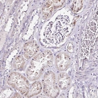 Immunohistochemical staining of human kidney shows weak cytoplasmic positivity in cells in tubules.
