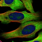 Immunofluorescent staining of human cell line U-2 OS shows localization to nucleoli, cytosol & endoplasmic reticulum.