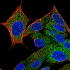 Anti-HPCAL4 Antibody