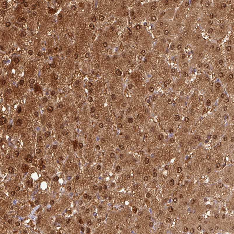 Anti-GSTA1 Antibody