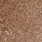 Anti-GSTA1 Antibody