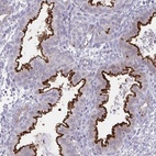 Anti-OR7A5 Antibody