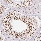 Immunohistochemical staining of human testis shows moderate to strong nuclear positivity in cells in seminiferous ducts.