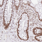 Immunohistochemical staining of human rectum shows strong nuclear positivity in glandular cells.