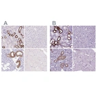 Immunohistochemical staining of human kidney, liver, salivary gland and skeletal muscle using Anti-BSND antibody HPA053836 (A) shows similar protein distribution across tissues to independent antibody HPA060617 (B).