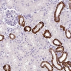 Immunohistochemical staining of human kidney shows strong membranous positivity in cells in tubules.