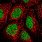 Immunofluorescent staining of human cell line HEK 293 shows localization to nucleoplasm.