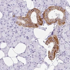 Immunohistochemical staining of human salivary gland shows moderate to strong membranous positivity in ductal cells.