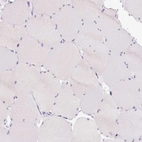 Immunohistochemical staining of human skeletal muscle shows no positivity in myocytes as expected.