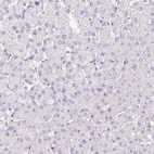 Immunohistochemical staining of human liver shows no positivity in hepatocytes as expected.
