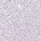 Immunohistochemical staining of human liver shows no positivity in hepatocytes as expected.