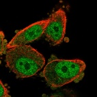 Anti-WT1 Antibody