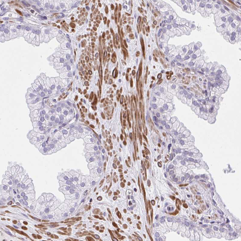 Anti-KCNN4 Antibody