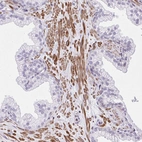 Anti-KCNN4 Antibody