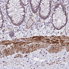 Immunohistochemical staining of human colon shows strong cytoplasmic/ membranous positivity in smooth muscle cells.