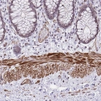 Immunohistochemical staining of human colon shows strong cytoplasmic/ membranous positivity in smooth muscle cells.