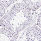 Immunohistochemical staining of human testis shows no positivity in cells in seminiferous ducts as expected.
