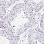Immunohistochemical staining of human testis shows no positivity in cells in seminiferous ducts as expected.