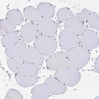 Immunohistochemical staining of human skeletal muscle shows no positivity in myocytes as expected.