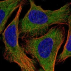 Immunofluorescent staining of human cell line U-2 OS shows localization to cytosol.
