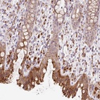 Anti-CEBPZOS Antibody