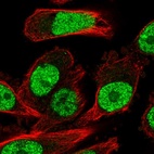 Immunofluorescent staining of human cell line PC-3 shows localization to nucleoplasm.