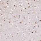 Anti-CLVS1 Antibody