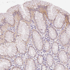 Anti-SH2D6 Antibody