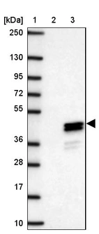 Lane 1: Marker [kDa] 250, 130, 95, 72, 55, 36, 28, 17, 10_br/_Lane 2: Negative control (vector only transfected HEK293T lysate)_br/_Lane 3: Over-expression lysate (Co-expressed with a C-terminal myc-DDK tag (~3.1 kDa) in mammalian HEK293T cells, LY406451)