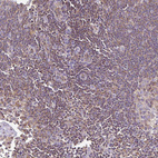 Anti-TWF2 Antibody