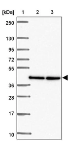 Lane 1: Marker [kDa] 250, 130, 95, 72, 55, 36, 28, 17, 10_br/_Lane 2: Human cell line RT-4_br/_Lane 3: Human cell line U-251MG sp
