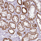 Immunohistochemical staining of human kidney shows strong granular cytoplasmic positivity in cells in tubules.