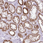 Immunohistochemical staining of human kidney shows strong granular cytoplasmic positivity in cells in tubules.