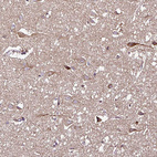 Immunohistochemical staining of human cerebral cortex shows moderate granular cytoplasmic positivity in neurons.