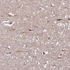 Immunohistochemical staining of human cerebral cortex shows moderate granular cytoplasmic positivity in neurons.