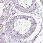 Immunohistochemical staining of human testis shows very weak granular cytoplasmic positivity in cells in seminiferous ducts.