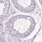 Immunohistochemical staining of human testis shows very weak granular cytoplasmic positivity in cells in seminiferous ducts.