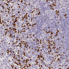 Anti-RCAN2 Antibody
