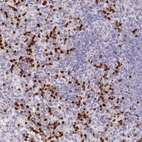 Anti-RCAN2 Antibody