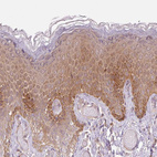 Immunohistochemical staining of human skin shows weak to moderate cytoplasmic positivity in squamous epithelial cells.