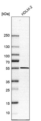 Western blot analysis in human cell line HDLM-2.