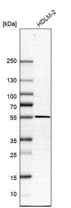 Western blot analysis in human cell line HDLM-2.