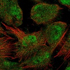 Immunofluorescent staining of human cell line U-251 MG shows localization to nucleoplasm & cytosol.