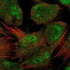 Immunofluorescent staining of human cell line U-251 MG shows localization to nucleoplasm & cytosol.