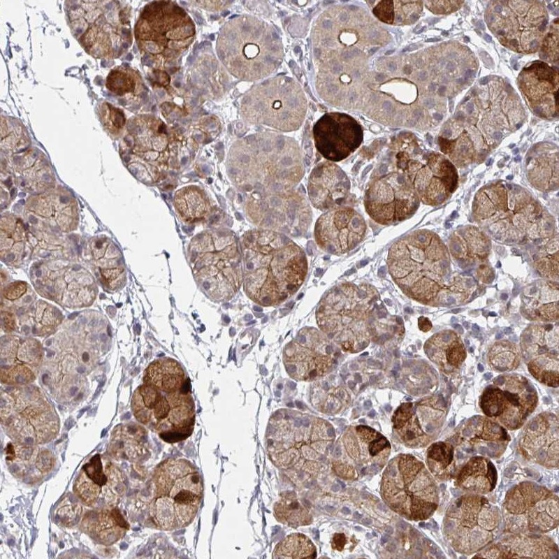 Anti-TMCC1 Antibody