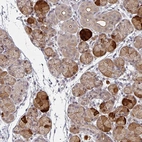 Anti-TMCC1 Antibody