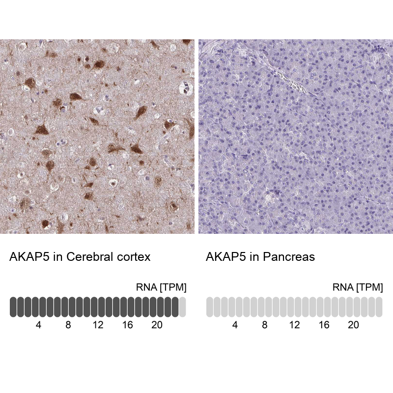 Anti-AKAP5 Antibody