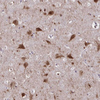 Immunohistochemical staining of human cerebral cortex shows strong cytoplasmic positivity in neurons.