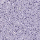 Immunohistochemical staining of human pancreas shows no cytoplasmic positivity in exocrine glandular cells as expected.